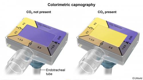 Colorimetric capnography